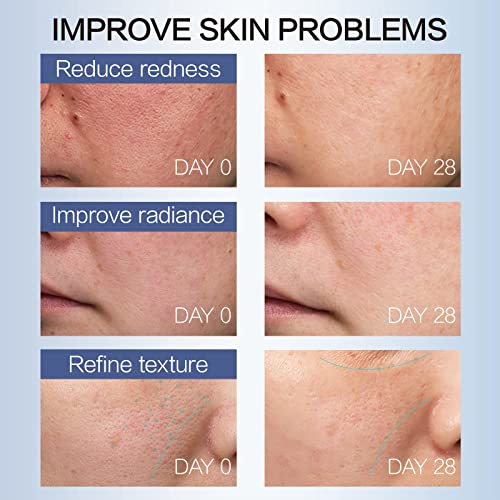 Antioksidativni serum za lice, posvjetljivanje dosadne kože + hijaluronska kiselina, revitalizirajući i hidratantni serum za lice,